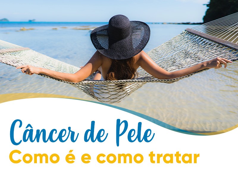 Cncer de pele: como  e como tratar